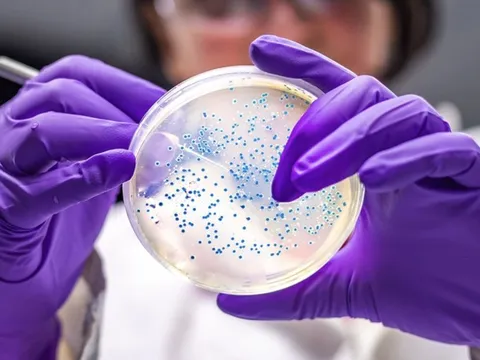 Công bố 29 siêu vi khuẩn nguy hiểm nhất với con người