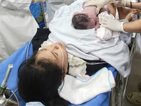 Hai bệnh viện ở Đồng Tháp phối hợp cứu sản phụ bị vỡ ối giữa đường lúc rạng sáng