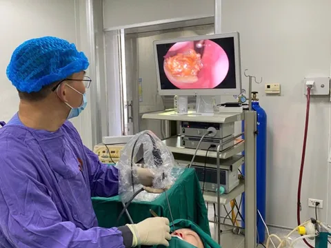 Hy hữu: Bị ngạt, không ngờ có sỏi trong hốc mũi