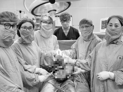 Phẫu thuật lấy khối u xơ tử cung khổng lồ lan rộng đến hạ sườn