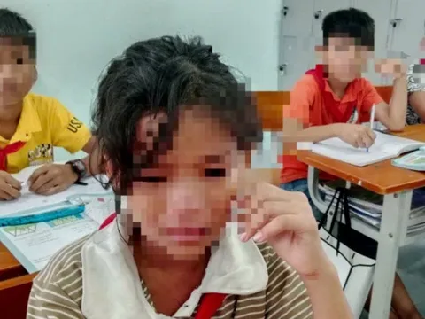 Học sinh bán trú đồng loạt không đi học sau vụ ngộ độc, phụ huynh nói ‘không yên tâm’