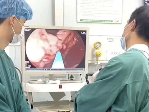 Người đàn ông đi ngoài phân đen, máu chảy thành tia trong dạ dày