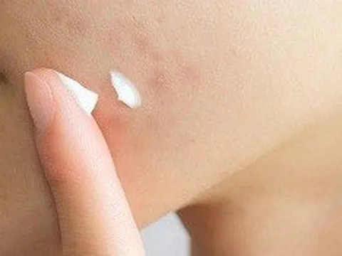 Thu hồi 46 loại mỹ phẩm trên toàn quốc