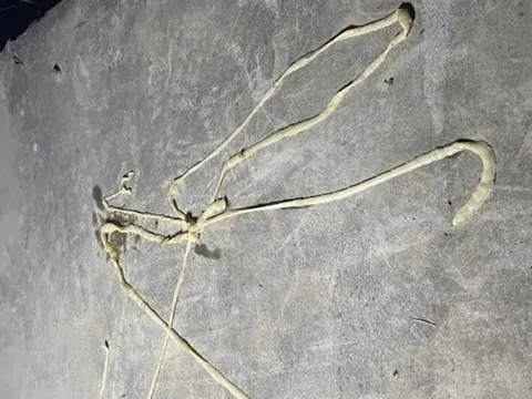 Rùng mình thấy sán lợn dài gần 10m ký sinh trong cơ thể bệnh nhân 37 tuổi