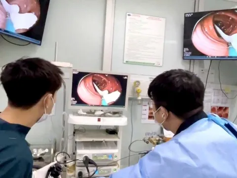 Sụt 2kg trong 2 tuần, phát hiện sán dây lợn dài gần 1m trong ruột